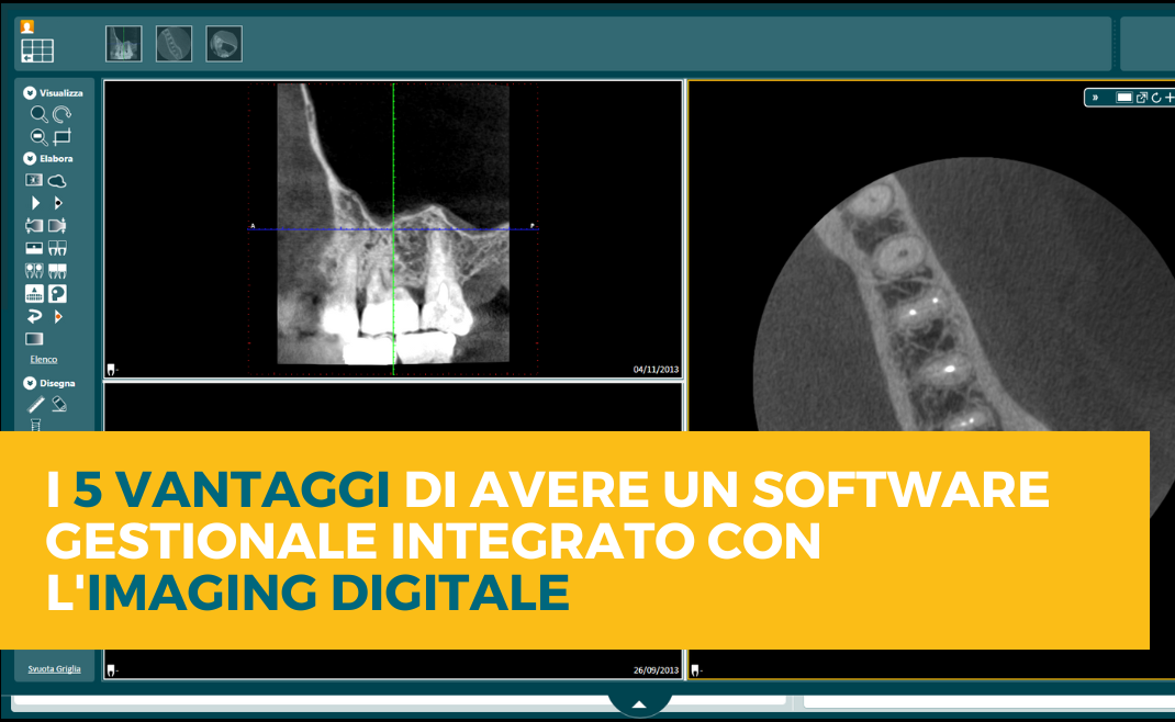 https://8880391.fs1.hubspotusercontent-na1.net/hubfs/8880391/I%205%20vantaggi%20di%20avere%20un%20software%20gestionale%20itegrato%20con%20imaging%20digitale.png